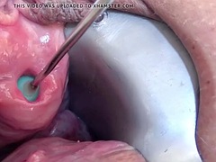 Stim99s eyehole fucked brutally with a huge dildo