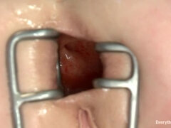 In den arsch, Dildo, Arschfick von zwei schwänzen, Fingern, Faustfick, Klaffend, Lesbisch, Hintern versohlen