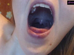 Inside My Mouth Sore Throat