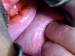 Anal, Extremo, Penetracion con puños, Abierta, Inserción
