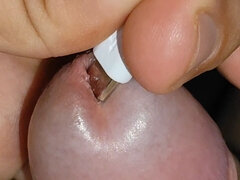 Electrical Introduction Into the Glans Opening.