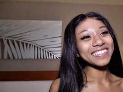 Analny, Hd