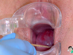 Silicone Sex Bomb Gets Treatment for Her Irritated Cervix