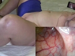 Amateur FreyjaAnalslut: Inside Amateur Analslut Freyja's arse - Air belly inflation and anal endoscope