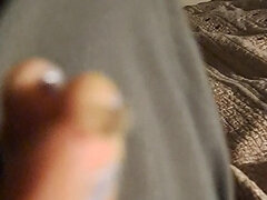 Peeling a Huge Toe Skin Flake