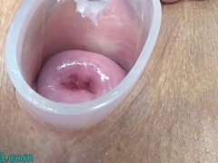 Japanese Wife Open Cervix Wide to watch inside Uterus