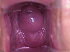 Kisbaba, Fétis, Nőgyógyász