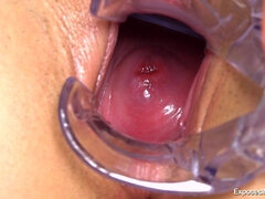 Brunetka, Gynekolog, Spodná bielizeň, Masturbácia, Sestrička, Sólo, Hračky