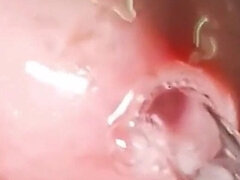 Oh My God! I Penetrate My Penis Eye!