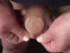 Foreskin with 32 items !