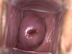 Kisbaba, Fétis, Nőgyógyász