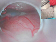 Asiat, Creme tærte, Ekstrem, Gynækologsex, Janpansk, Koreaner, Gravid, Kone