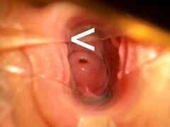 Chaturbatable spreads pussy with speculum and gives anatomy lesson - Fetish