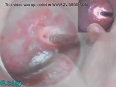 Japanese Endoscope Camera inside Cervix Cam into Pussy Uterus