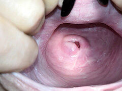 Nubile, cervix, close