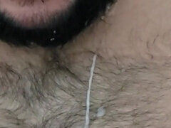 Ondó fröcskölés, Szőrös