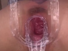 Amatőr, Popó, Hatalmas hátsó, Nuni, Leborotvált, Szajha