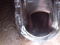 Cum Cervix Insemination