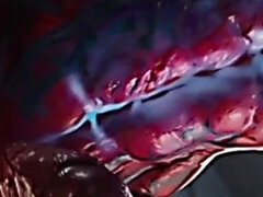 D3d Intense Hardcore Anal Compilation: Deep Creampies, Extreme Gaping, and Dripping Pleasure