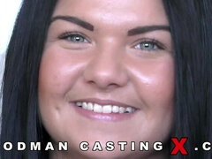Analno, Najstnice