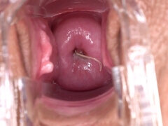 Hd, Maszti, Nuni, Egyedül