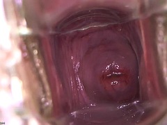 Baben, Fetisch, Gynekologi