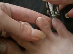 Long Toenail Clipping
