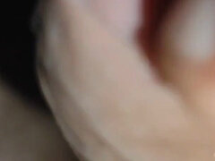 Young Man with Phimosis Opening the Glans