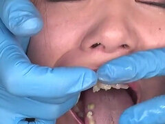 Honoka Sakamoto Trapped: Tongue Clamps, Stretched Face, and No Way Out