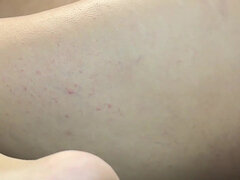 18, Anaali, Perse, Iso perse, Suihinotto, Latinankieli, Punapää, Teini