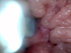 Endoscope Camera Shows the Most Sensitive Parts of the Penis Educational Video
