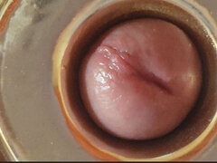 Boy Close up Tight Uncircumcised Glans Excited