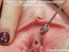 Dirtygardengirl three diffrent magnitude peehole injections