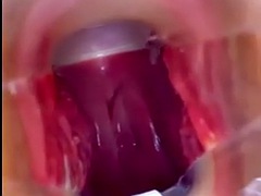 Vagina, cervix Rhythmically hit the orgasm vaginal endoscope with strong suction, squeezing and raising the spike.