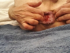 Inflatable Plug, 7cm