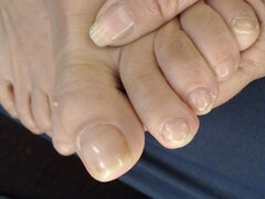 Ερασιτέχνης, Ποδολαγνεία, Ώριμη, Μόνος