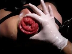 Amatéři, Anál, Prstění