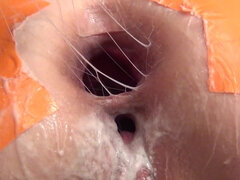 Anál, Fisting, Zející