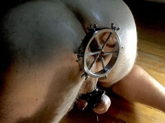 Anal Metal Dilator. Fitting in a Narrow Anus.