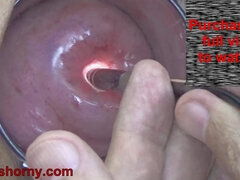 Mature Wife Cervix Playing with Endoscope Japanese Cam into Uterus